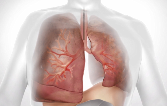 lung-20221231_g9.jpg