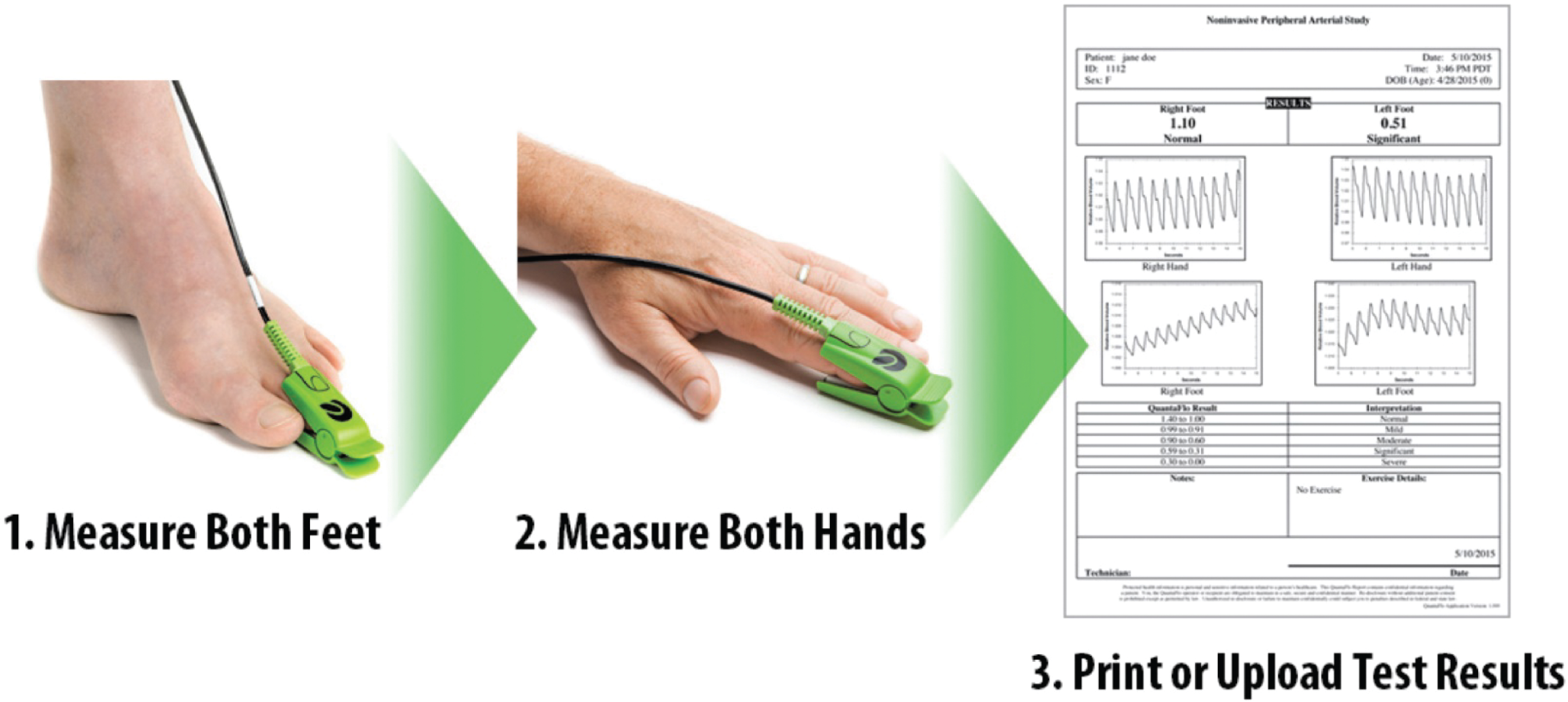 [MISSING IMAGE: tm205403-ph_measure4clr.jpg]