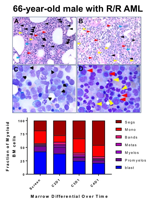 C:\Users\kdefran\Desktop\Syros Pharmaceuticals, Inc_10K_20180306\p13 differentiation.jpg