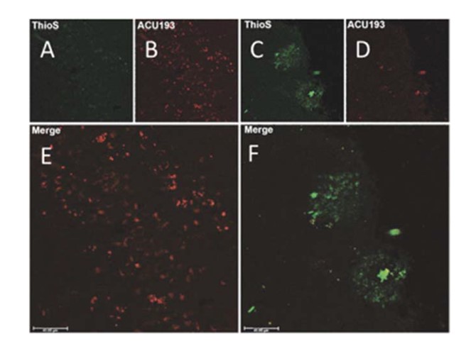 Figure 8_2025 10K_ABOs vs Amyloid Plaques.jpg
