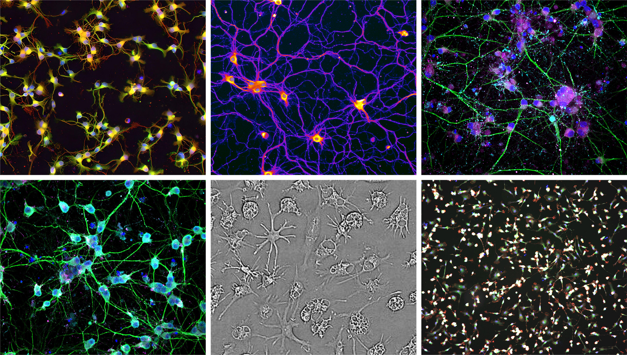 fig 13_various cells grown.jpg