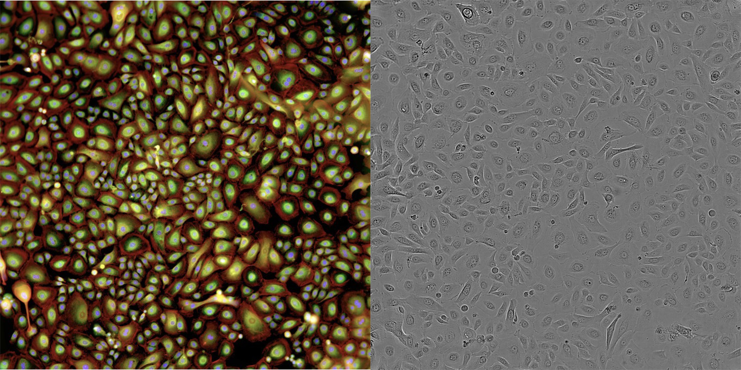 fig 15_cellpaint brightfield photos.jpg