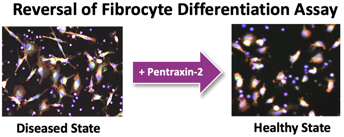 fig 59_disease vs healthy state.jpg